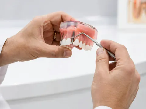 Dentist holding a partial denture